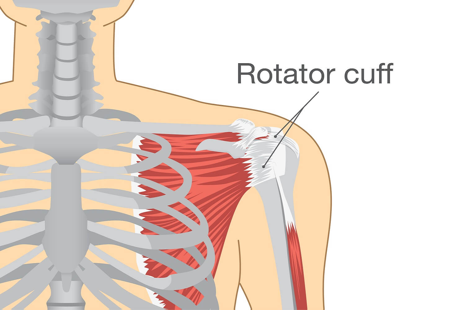 how-to-prevent-injuring-your-rotator-cuff